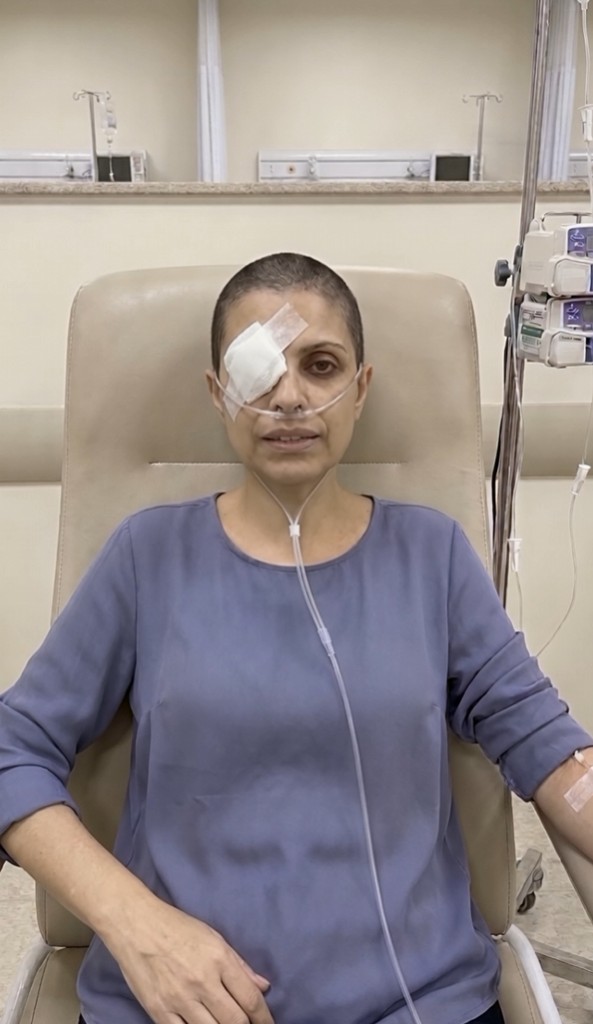 Natacha durante uma sessão de tratamento, com curativo sobre um dos olhos e cateter no braço